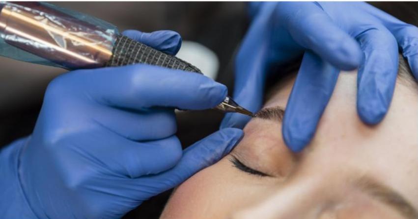 5 dolog, amit a lézeres sminktetoválás eltávolításról tudnod kell